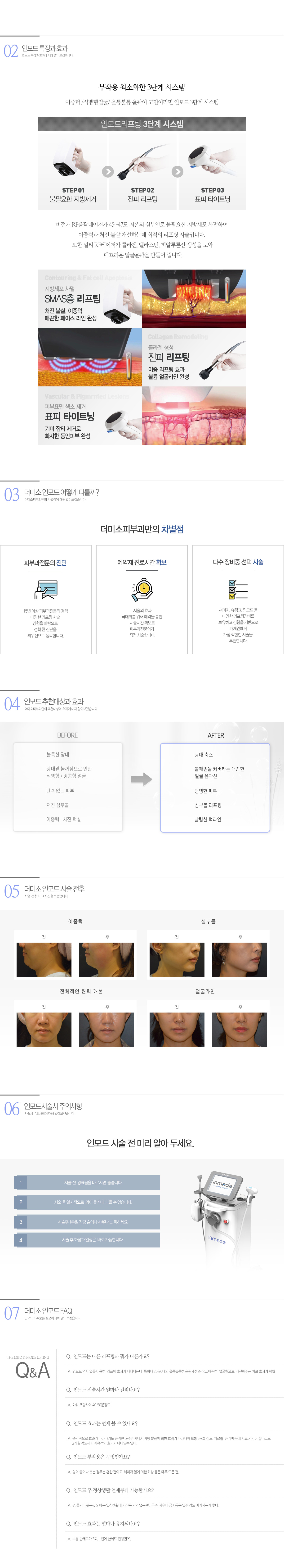 인모드 리프팅 상세설명02
